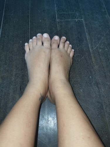 28week. เท้าบวม