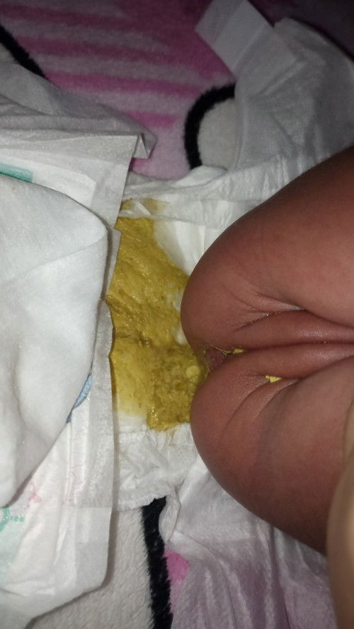 Pup bayi 1 bulan begini sufor bun bagi pengalamanya saya ibu baru kuatir apa karena nggak cocok?