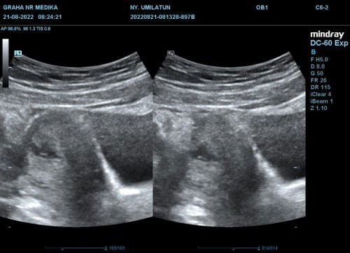 Hasil USG menggemaskan😘