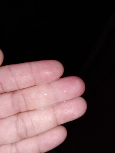 มีน้ำสีขาวขุ่นไหลตลอดเลยค่ะไหลมาเป็นอาทิตแล้วจะเป็นอัตรายมั้ยค่ะ36วิคค่ะ