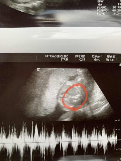 ซาวด์ตอน 19week