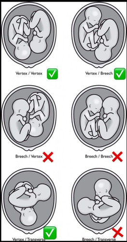 Kedudukan baby