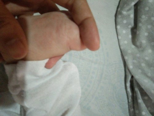 Maliliit na butlig sa paa ni baby, ano po kya Ito mga mommy?and ano po gamot po Dito?Thank you po.