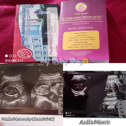 Alhamdulillah kontrol Usg