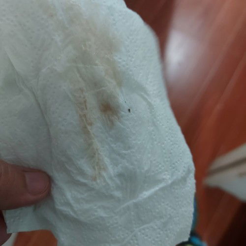 Mga mamsh, FTM here 38 wks and 2days, malapit na po ba ako? Masakit na rin puson ko pa minsan2x