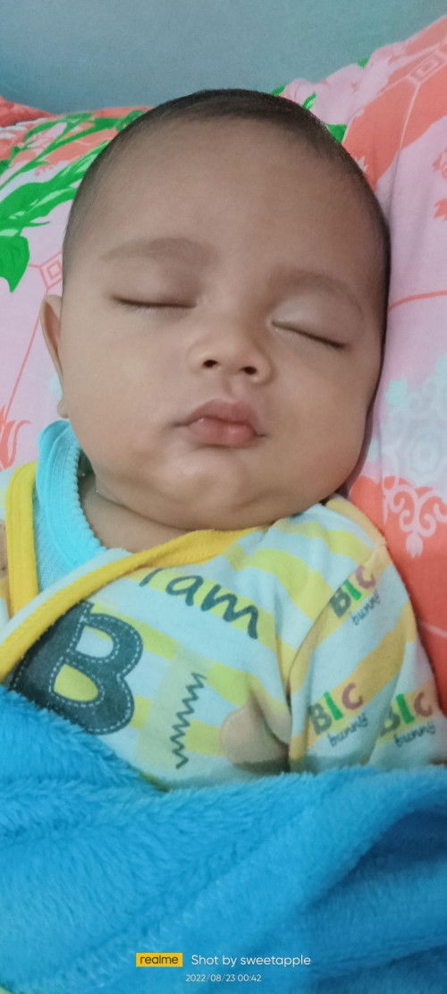 Warna kulit bayi
