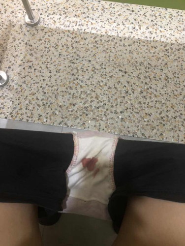 Bleeding question