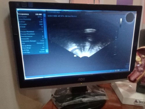 Bahalgaimanakah cara menghitung kehamilan yang sebenernya itu? 
Apa dari hpht /hri suci heid?