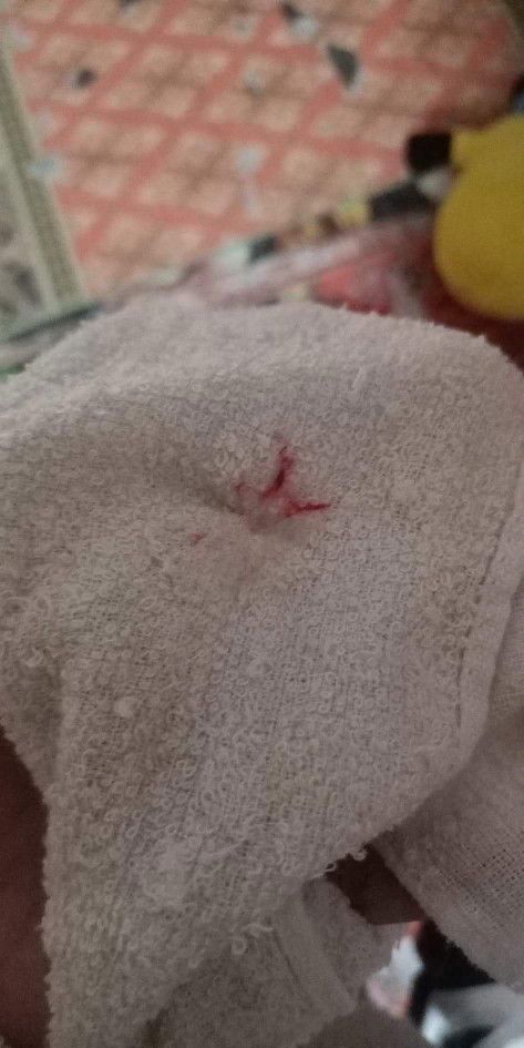 ลูก1ปี 18วัน มีเลือดออกทางจมูกพร้อมกับน้ำมูก แบบนี้จะเป็นอันตรายมั้ยคะ