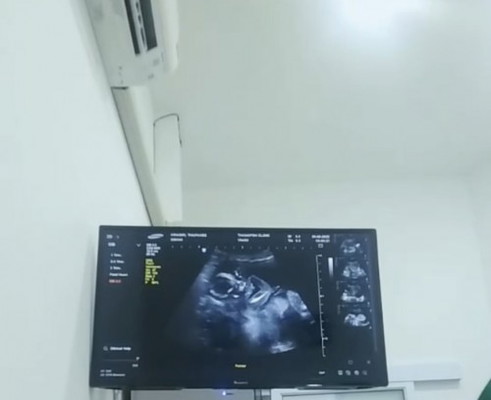 19weekน้องดูดนิ้วโชว์แล้วค้าบ