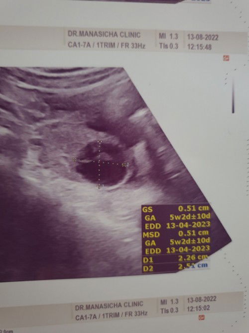 รบกวนช่วยดูหน่อยค่ะ