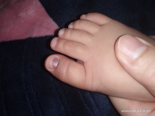 speaker jatuh atas kaki anak