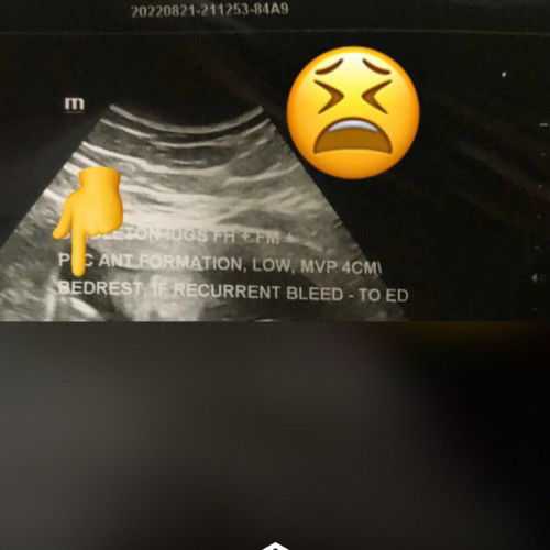 Doc advise u Bedrest