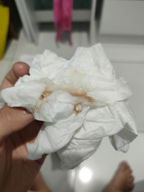 Keluar flek coklat kemerahan usia kandungan 39 weeks 3 hari