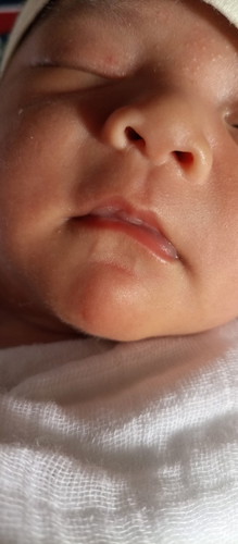 Pale lips after breastfeed