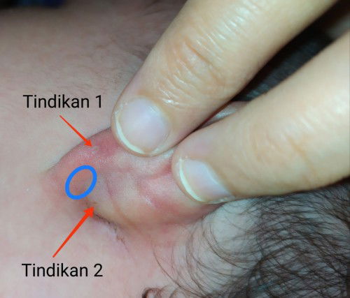 Rekomendasi Tempat Tindik Bayi