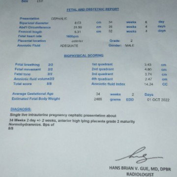 pakibasa naman po Neto Bps Kopo
