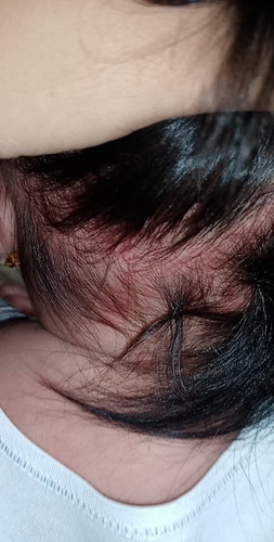 mga momsh, ano po ba ito?