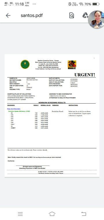 Kaninong baby ang nagkaroon na ng CUD or Inborn Error Of Metabolism?