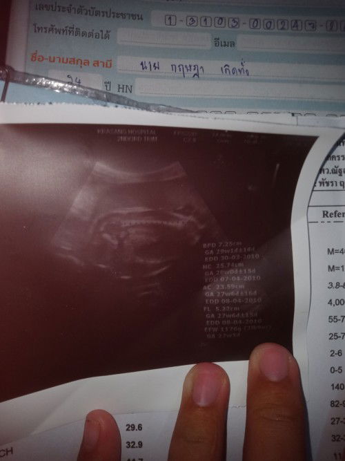 ท้องแรกจ้า