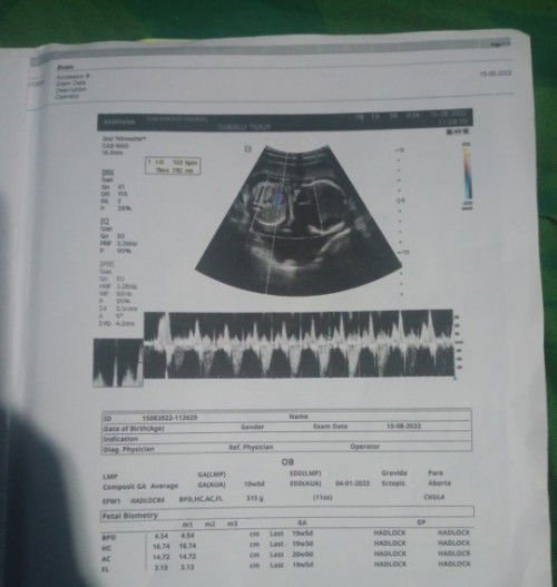 ดูภาพอัลตร้าซาวด์เป็นบ้างค่าา