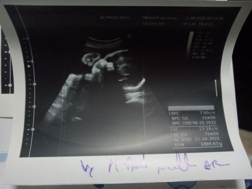 แม่ๆช่วยดูหน่อยค่ะ