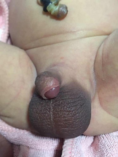 สอบถามค่ะ
อวัยวะเพศลูกชาย
