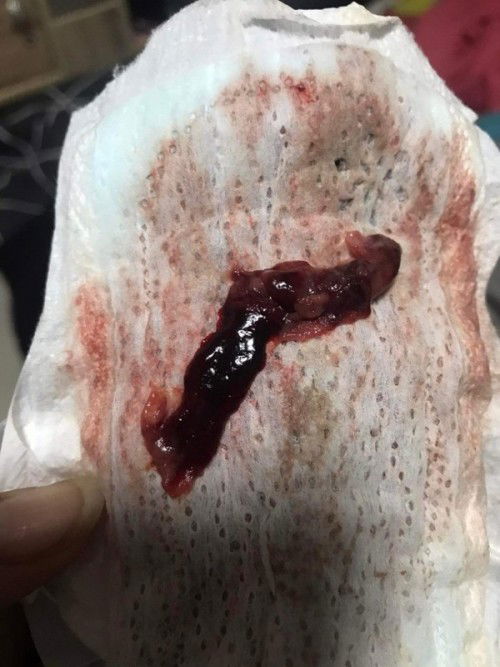 ขอถามหน่อยค่ะและขอโทษ ณ.ที่นี้ด้วยเนื่องจากรูปภาพไม่สุภาพ