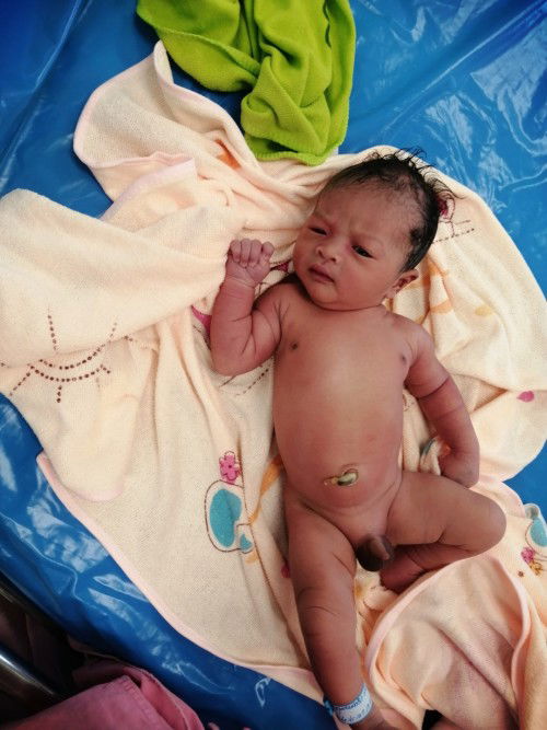 ติดเชื้อซิฟิลิสจากแม่