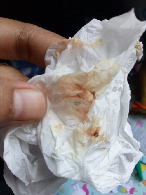 Telat haid keluar lendir bercampur darah semu coklat