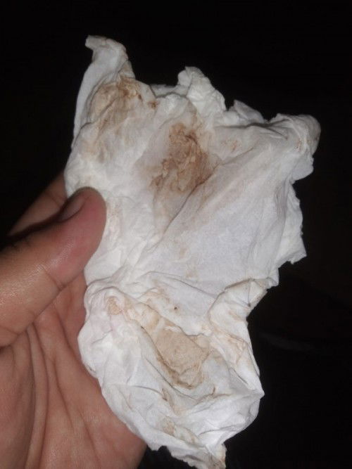 37w6d keluar flek coklat