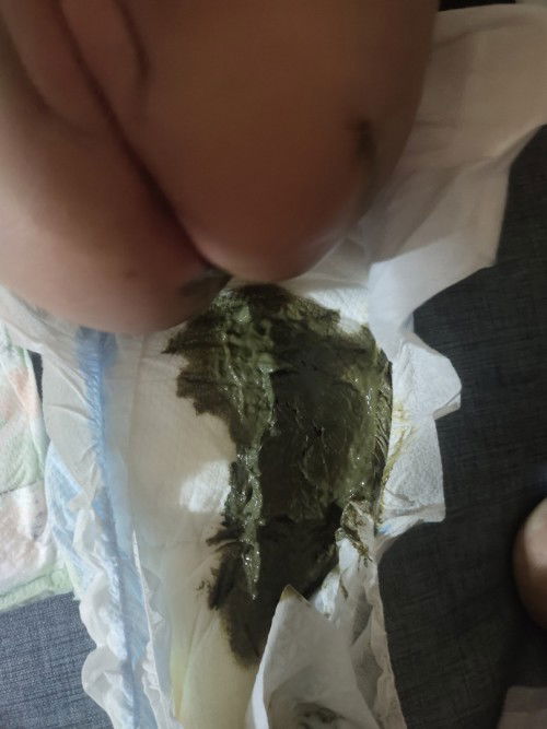 Mommies normal lang ba pag ganito poops ni baby? Im worried