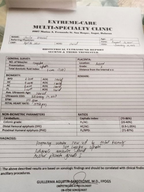 Nalilito lang ako sa weeks