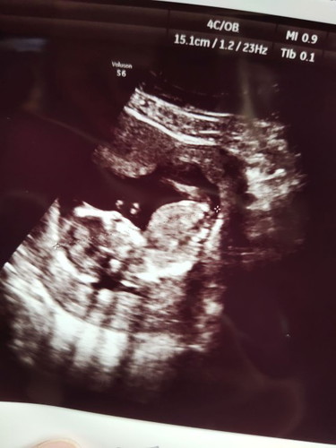 nak tau jantina bayi :)