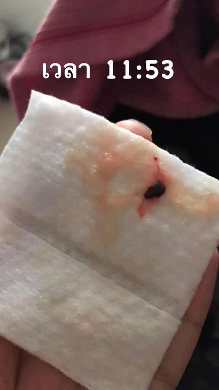 สอบถามแม่ๆหน่อยค่ะ