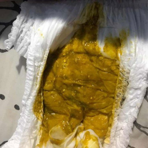 ถ่ายมีมูกเหลืองเขียว ปกติมั้ยค่ะ