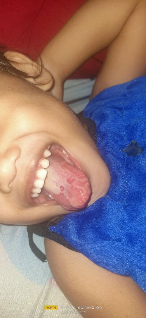 benda pelik kat mulut anak