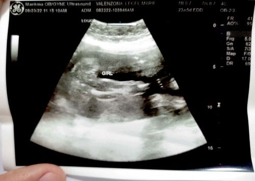 Latest ultrasound