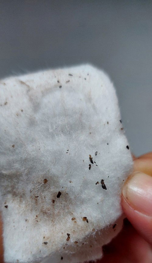 kulit kering pada PD