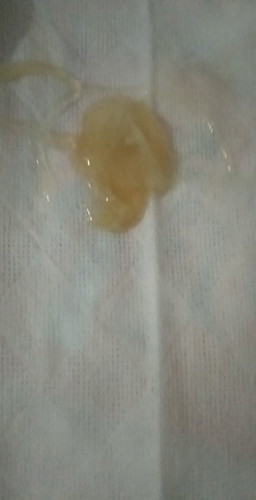 40 weeks pregnant na po ako anu po ibig sabihin pag nilabasan na nang mucos pero walang blood?