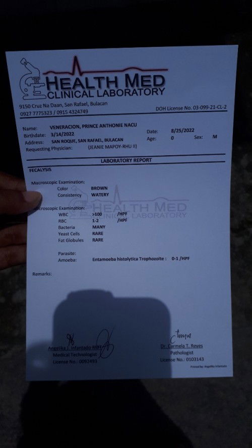 Si baby nagka Amoeba 😞