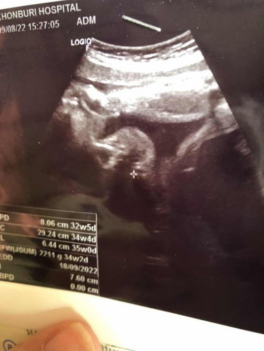 สอบถามค่ะแม่ๆ