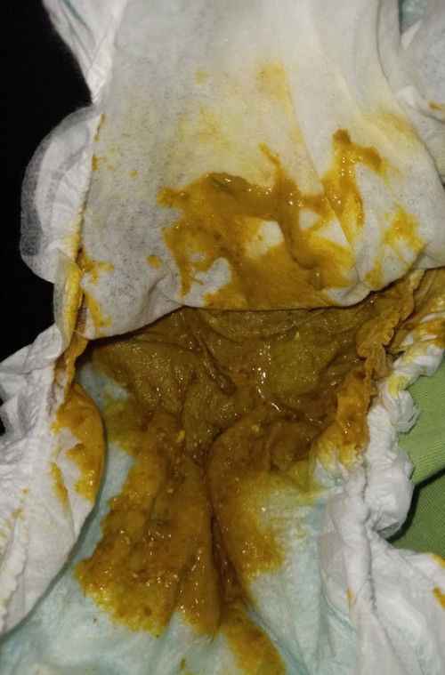 Need some advice mga mii...