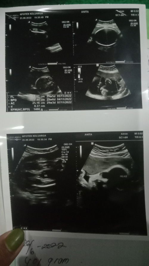 10 Minggu terakhir yg mendebarkan 🥰