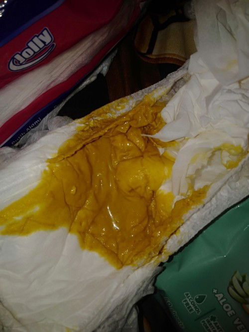 Apakah ini diare bun