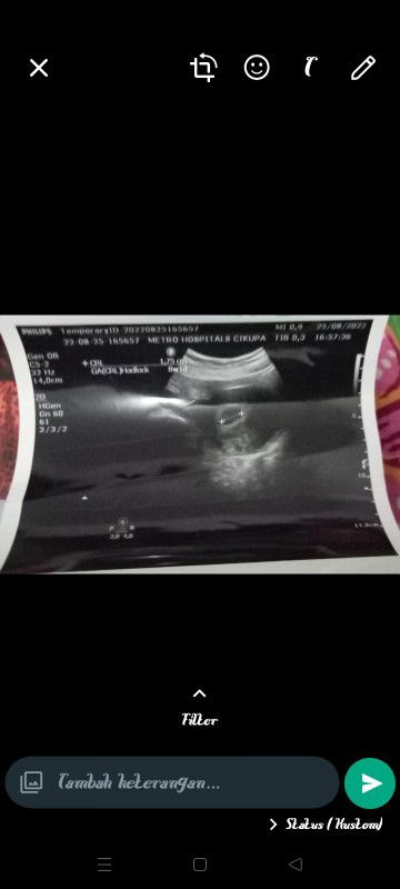 Ngefelek sudah 12 hari tp gak berenti "