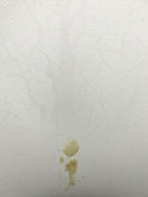 Mucus plug po ba ito