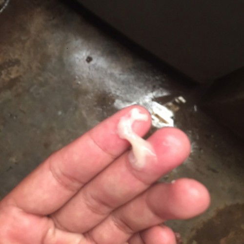 มีมูกออกมาแบบนี้