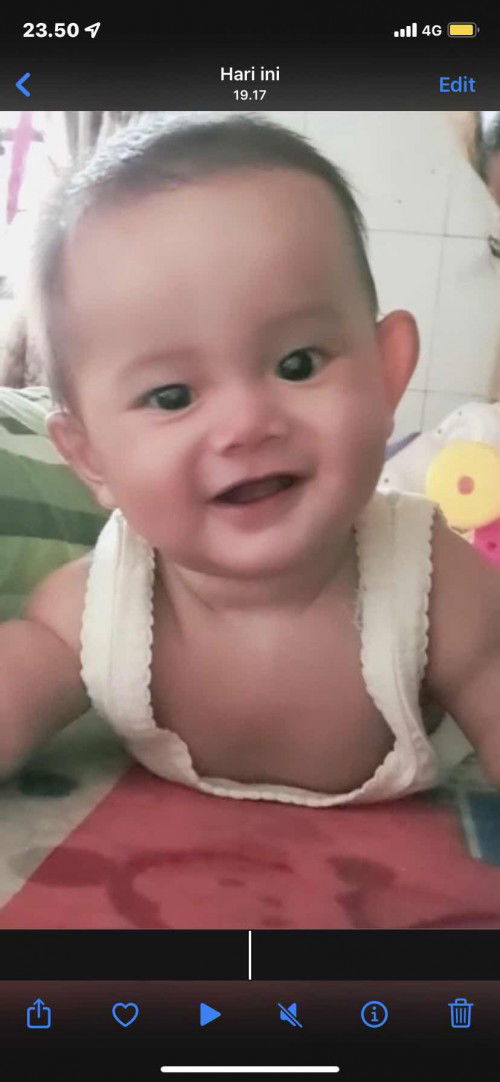 Telinga bayi besar sebelah