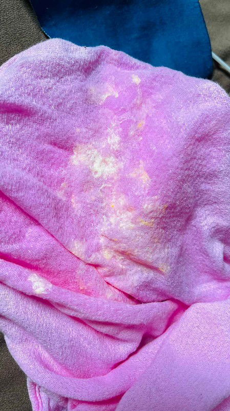 อาเจียนมีสีเหลืองปน